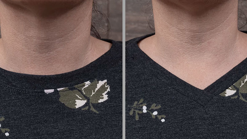 Can You Get a Neckline Altered?